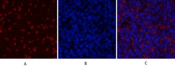 JAK2 rabbit pAb Antibody