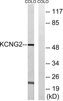 KCNG2 rabbit pAb Antibody