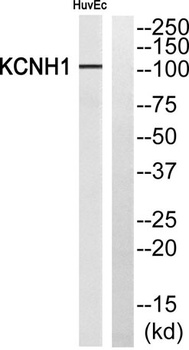 KCNH1 rabbit pAb Antibody