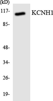 KCNH1 rabbit pAb Antibody