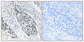 KDEL Receptor 2 rabbit pAb Antibody
