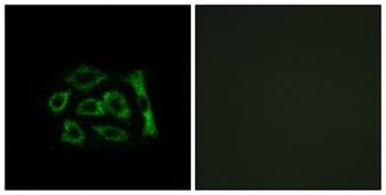 KDEL Receptor 2 rabbit pAb Antibody