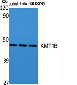 KMT1B rabbit pAb Antibody