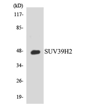 KMT1B rabbit pAb Antibody