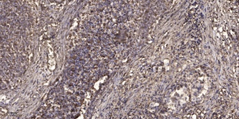 KMT1B rabbit pAb Antibody