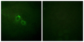 Kv1.3 rabbit pAb Antibody