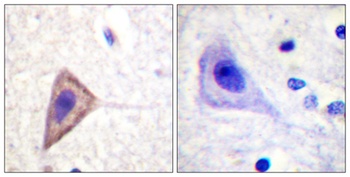 Kv1.3 rabbit pAb Antibody