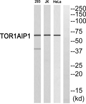 LAP1B rabbit pAb Antibody