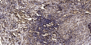 LAP1B rabbit pAb Antibody
