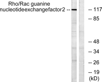 Lfc rabbit pAb Antibody