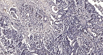 Liprin β1 rabbit pAb Antibody