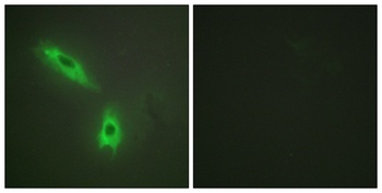 LT-β rabbit pAb Antibody