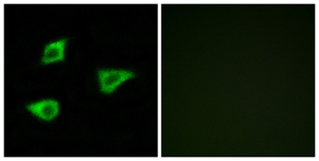 mAChR M4 rabbit pAb Antibody