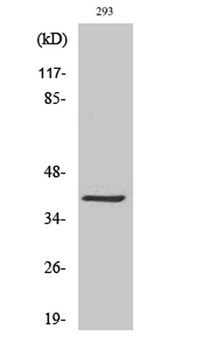 MAGE-C2 rabbit pAb Antibody