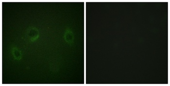 MARK1/2/3/4 rabbit pAb Antibody