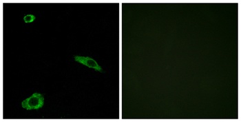 MC2-R rabbit pAb Antibody
