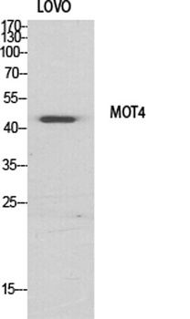 MCT4 rabbit pAb Antibody