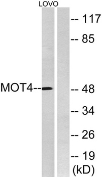 MCT4 rabbit pAb Antibody