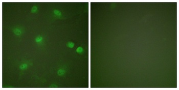 MEF-2 rabbit pAb Antibody