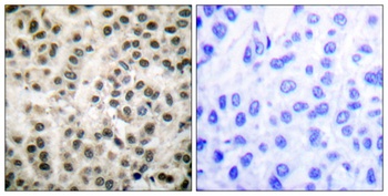 MEF-2 rabbit pAb Antibody