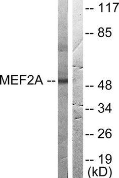 MEF-2 rabbit pAb Antibody