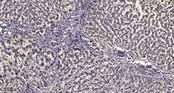 MEK Kinase-3 rabbit pAb Antibody