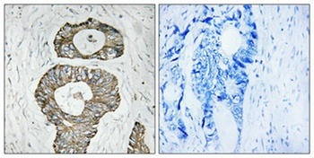 Met rabbit pAb Antibody