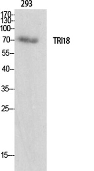Midline-1 rabbit pAb Antibody