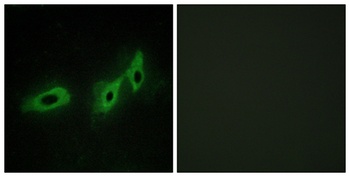 Midline-1 rabbit pAb Antibody
