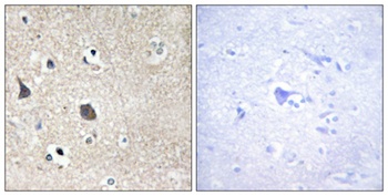 Midline-1 rabbit pAb Antibody