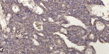 ML-IAP rabbit pAb Antibody