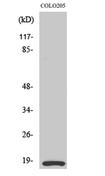 MRLC2 rabbit pAb Antibody