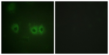 MRLC2 rabbit pAb Antibody