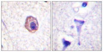 MRLC2 rabbit pAb Antibody