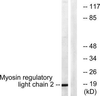 MRLC2 rabbit pAb Antibody