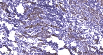 MRP3 rabbit pAb Antibody