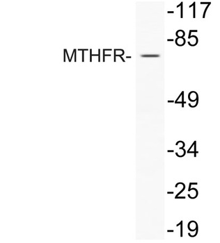 MTHFR rabbit pAb Antibody