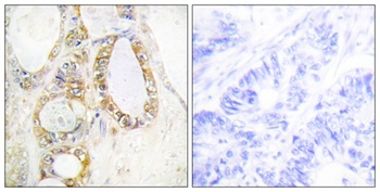 Mucin 13 rabbit pAb Antibody