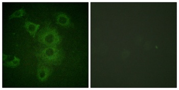 NBK rabbit pAb Antibody