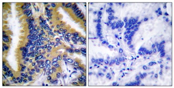 NBK rabbit pAb Antibody
