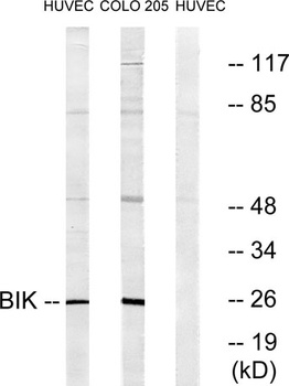 NBK rabbit pAb Antibody