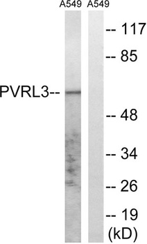Nectin 3 rabbit pAb Antibody