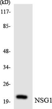 NEEP21 rabbit pAb Antibody