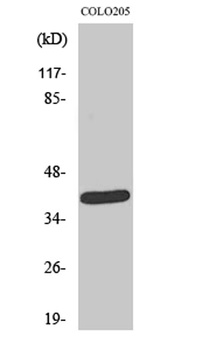 NEGR1 rabbit pAb Antibody