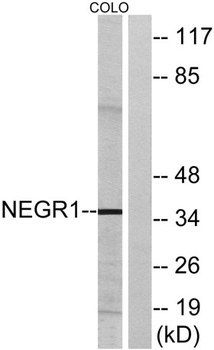 NEGR1 rabbit pAb Antibody