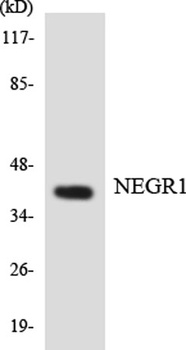 NEGR1 rabbit pAb Antibody