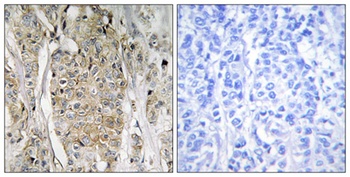 Neu rabbit pAb Antibody