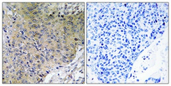 NF2 rabbit pAb Antibody