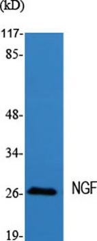 NGF rabbit pAb Antibody