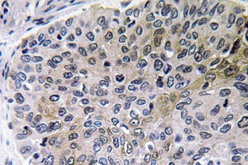 NGF rabbit pAb Antibody